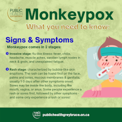Monkeypox symptoms infographic